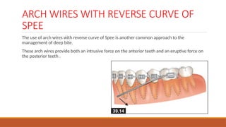 Bite Wire DEEP BITE \ VERTICAL PLANE DISCREPANCIES .pptx