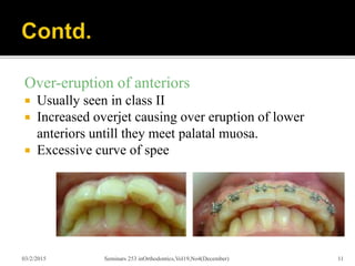 Over Eruption Deep bite(1) | PPTX