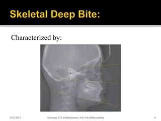Deep bite(1) | PPTX