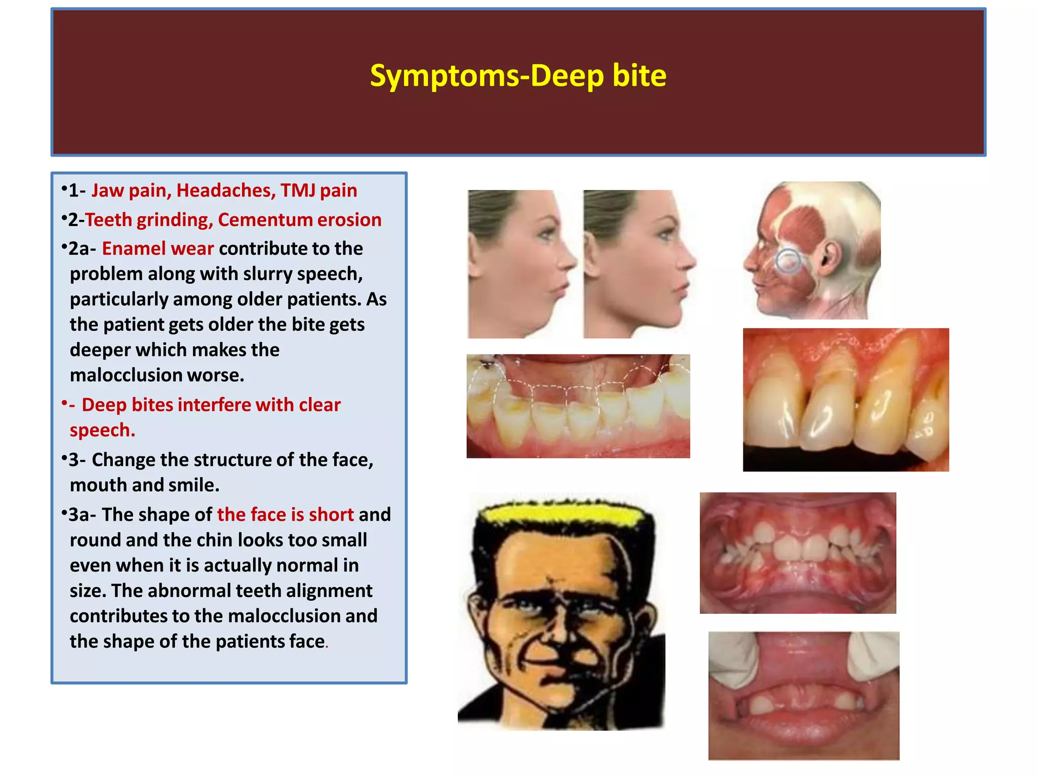 Symptoms-Deep bite
•1- Jaw pain, Headaches, TMJ pain
•2-Teeth grinding, Cementum erosion
•2a- Enamel wear contribute to the
problem along with slurry speech,
particularly among older patients. As
the patient gets older the bite gets
deeper which makes the
malocclusion worse.
•- Deep bites interfere with clear
speech.
•3- Change the structure of the face,
mouth and smile.
•3a- The shape of the face is short and
round and the chin looks too small
even when it is actually normal in
size. The abnormal teeth alignment
contributes to the malocclusion and
the shape of the patients face.
 