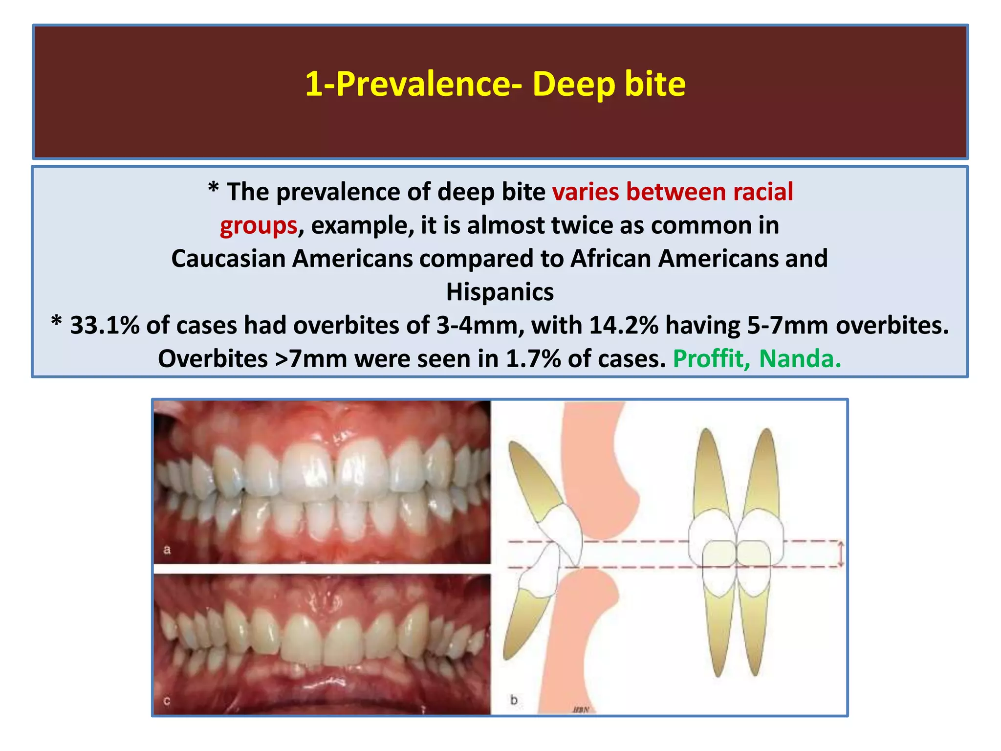 1-Prevalence- Deep bite
* The prevalence of deep bite varies between racial
groups, example, it is almost twice as common in
Caucasian Americans compared to African Americans and
Hispanics
* 33.1% of cases had overbites of 3-4mm, with 14.2% having 5-7mm overbites.
Overbites >7mm were seen in 1.7% of cases. Proffit, Nanda.
 