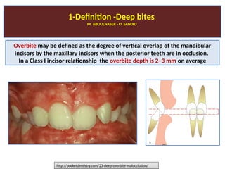 Deep bite malocclusions-M. ABOULNASER- Orthodontist, BUA, USA. O ...