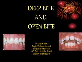 DEEP BITE
AND
OPEN BITE
Dr.Kailash Rathi
Dept of Orthodontics and
Dentofacial Orthopedics
S.B. Patil intitute for Dental
Sciences and Research
 