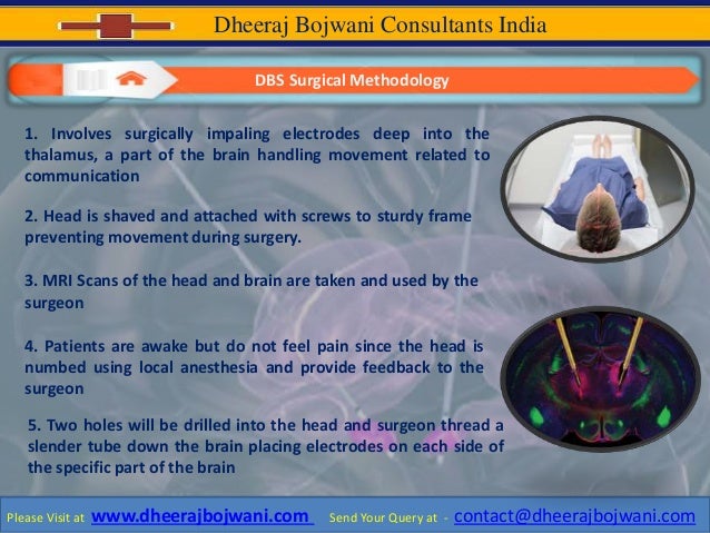 Deep brain stimulation therapy India