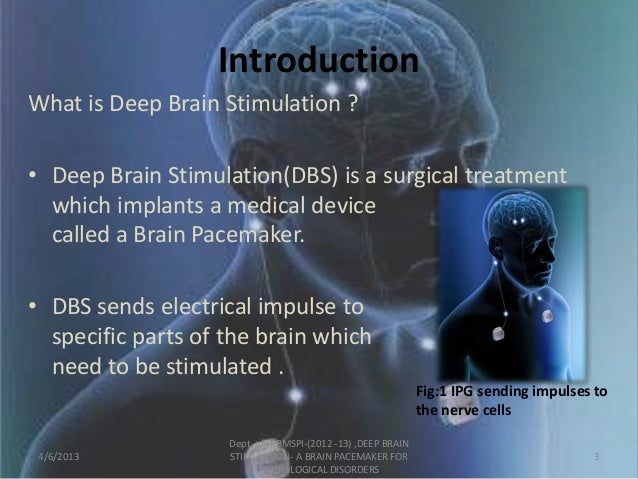 Dbs for depression