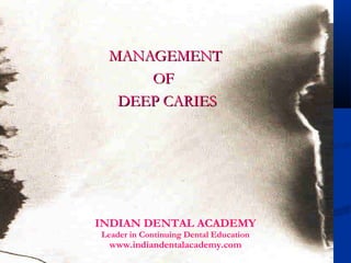MANAGEMENT
     OF
  DEEP CARIES




INDIAN DENTAL ACADEMY
Leader in Continuing Dental Education
    www.indiandentalacademy.com
  www.indiandentalacademy.com
 