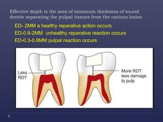 Effective depth is the area of minimum thickness of sound
dentin separating the pulpal tissues from the carious lesion
 ED- 2MM a healthy reparative action occurs
 ED-0.8-2MM unhealthy reparative reaction occurs
 ED-0.3-0.8MM pulpal reaction occurs
 