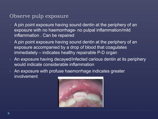 Observe pulp exposure
 A pin point exposure having sound dentin at the periphery of an
exposure with no haemorrhage- no pulpal inflammation/mild
inflammation . Can be repaired
 A pin point exposure having sound dentin at the periphery of an
exposure accompanied by a drop of blood that coagulates
immediately – indicates healthy repairable P-D organ
 An exposure having decayed/infected carious dentin at its periphery
would indicate considerable inflammation
 An exposure with profuse haemorrhage indicates greater
involvement
 