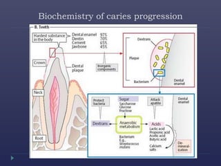 Biochemistry of caries progression
 