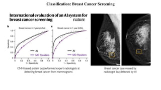 Classification: Breast Cancer Screening
 