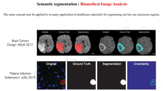 Semantic segmentation : Biomedical Image Analysis
The same concept may be applied to so many application in healthcare especially for segmenting out lets say cancerous regions.
 