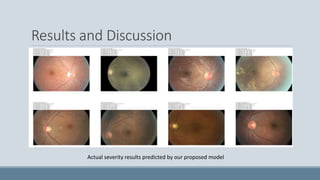 Results and Discussion
Actual severity results predicted by our proposed model
 