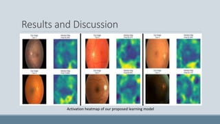 Results and Discussion
Activation heatmap of our proposed learning model
 