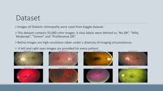 Dataset
Images of Diabetic retinopathy were used from Kaggle dataset.
This dataset contains 35,000 color images. 5 class labels were defined as “No DR”, “Mild,
Moderate”, “Severe” and “Proliferative DR”.
Retina images are high-resolution taken under a diversity of imaging circumstances.
 A left and right eyes images are provided for every patient.
 