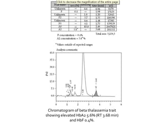 Chromatogram of beta thalassemia trait
showing elevated HbA2 5.6% (RT 3.68 min)
and HbF 0.4%.
 