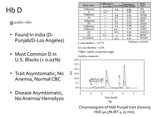 Chromatogram of HbD Punjab trait showing
HbD 40.5% (RT 4.15 min).
Β121Glu→Gln
• Found In India (D-
Punjab/D-Los Angeles)
• Most Common D In
U.S. Blacks (< 0.02%)
• Trait Asymtomatic, No
Anemia, Normal CBC
• Disease Asymtomatic,
No Anemia/ Hemolysis
Hb D
 