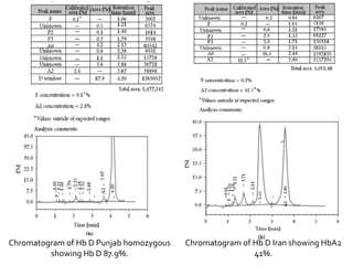 Chromatogram of Hb D Punjab homozygous
showing Hb D 87.9%.
Chromatogram of Hb D Iran showing HbA2
41%.
 