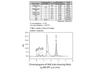 Chromatogram of HbE trait showing HbA2
24.8% (RT 3.72 min).
 