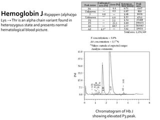 Chromatogram of Hb J
showing elevated P3 peak.
Hemoglobin J-Rajappen (alpha)90
Lys →Thr is an alpha chain variant found in
heterozygous state and presents normal
hematological blood picture.
 