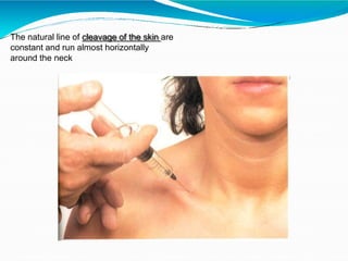 The natural line of cleavage of the skin are
constant and run almost horizontally
around the neck
 