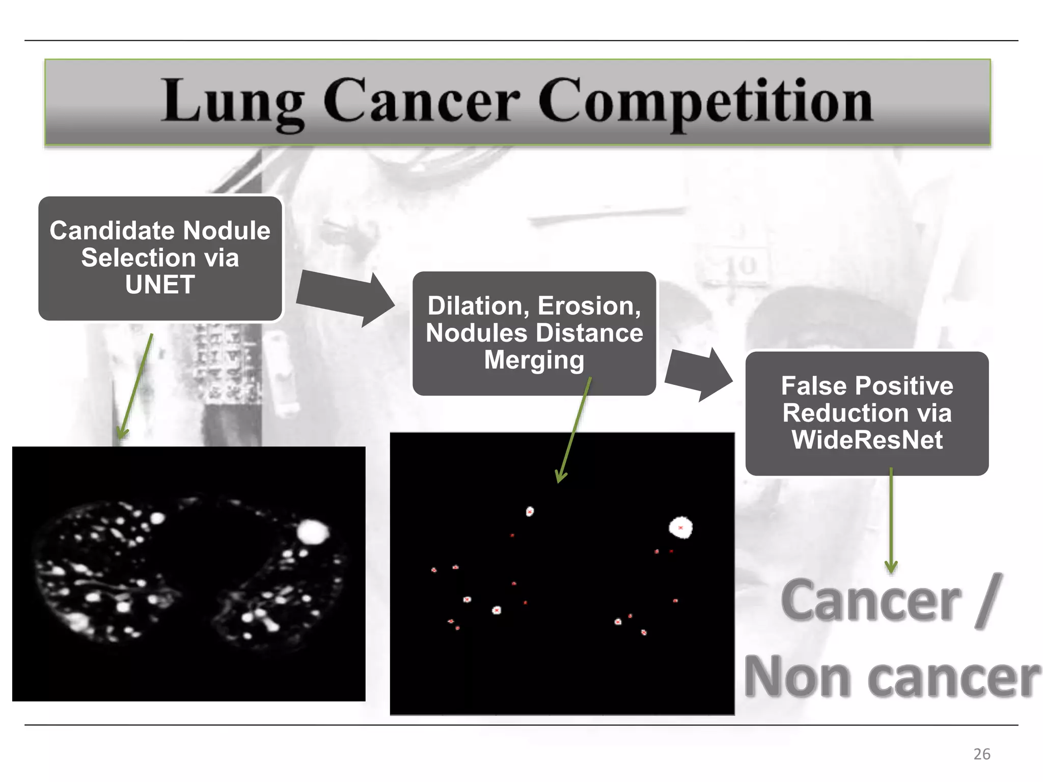 26
Candidate Nodule
Selection via
UNET
Dilation, Erosion,
Nodules Distance
Merging
False Positive
Reduction via
WideResNet
 