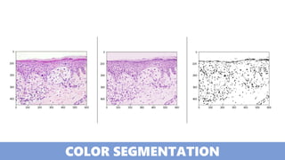 COLOR SEGMENTATION
 