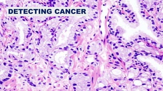 DETECTING CANCER
 