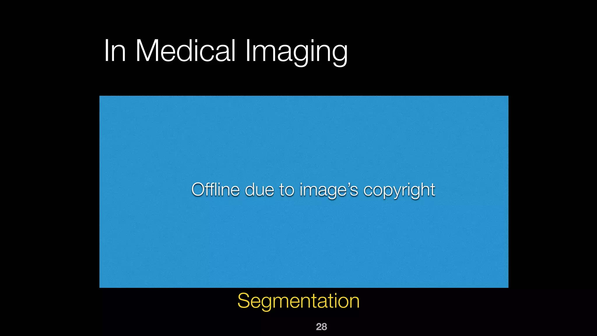 28
In Medical Imaging
Segmentation
Ofﬂine due to image’s copyright
 