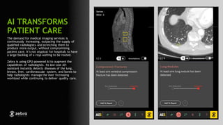 113
The demand for medical imaging services is
continuously increasing, outpacing the supply of
qualified radiologists and stretching them to
produce more output, without compromising
patient care. It’s not atypical for hospitals to have
a large backlog of x-rays waiting to be routed.
Zebra is using GPU-powered AI to augment the
capabilities of radiologists. Its low-cost AI1
assistant instantly detects diseases of the lung,
breast, liver, cardiovascular system, and bones to
help radiologists manage the ever increasing
workload while continuing to deliver quality care.
AI TRANSFORMS
PATIENT CARE
 