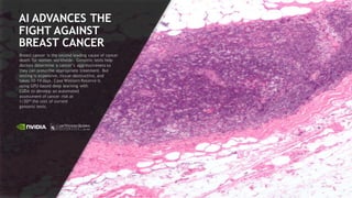 19
AI ADVANCES THE
FIGHT AGAINST
BREAST CANCER
Breast cancer is the second leading cause of cancer
death for women worldwide. Genomic tests help
doctors determine a cancer’s aggressiveness so
they can prescribe appropriate treatment. But
testing is expensive, tissue-destructive, and
takes 10-14 days. Case Western Reserve is
using GPU-based deep learning with
CUDA to develop an automated
assessment of cancer risk at
1/20th the cost of current
genomic tests.
 