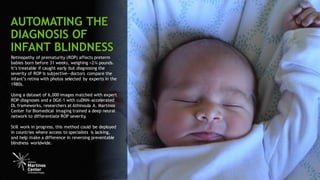 5
Retinopathy of prematurity (ROP) affects preterm
babies born before 31 weeks, weighing <2¾ pounds.
It’s treatable if caught early but diagnosing the
severity of ROP is subjective—doctors compare the
infant’s retina with photos selected by experts in the
1980s.
Using a dataset of 6,000 images matched with expert
ROP diagnoses and a DGX-1 with cuDNN-accelerated
DL frameworks, researchers at Athinoula A. Martinos
Center for Biomedical Imaging trained a deep neural
network to differentiate ROP severity.
Still work in progress, this method could be deployed
in countries where access to specialists is lacking,
and help make a difference in reversing preventable
blindness worldwide.
AUTOMATING THE
DIAGNOSIS OF
INFANT BLINDNESS
 