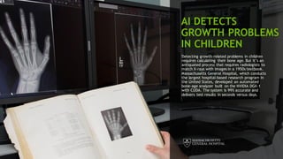 51
AI DETECTS
GROWTH PROBLEMS
IN CHILDREN
Detecting growth-related problems in children
requires calculating their bone age. But it’s an
antiquated process that requires radiologists to
match X-rays with images in a 1950s textbook.
Massachusetts General Hospital, which conducts
the largest hospital-based research program in
the United States, developed an automated
bone-age analyzer built on the NVIDIA DGX-1
with CUDA. The system is 99% accurate and
delivers test results in seconds versus days.
 