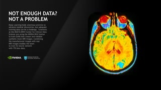 52
NOT ENOUGH DATA?
NOT A PROBLEM
Deep Learning holds enormous promise to
advance medical discoveries, but adequate
training data can be a challenge. Scientists
at the MGH & BWH Center for Clinical Data
Science are using the NVIDIA DGX Station
to train GANs that create and validate
synthetic brain MRI images. Combining
the manufactured images with real
MRI images enables the team
to train its neural network
with 75% less data.
 