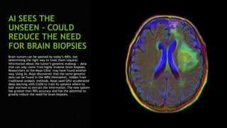 54
AI SEES THE
UNSEEN – COULD
REDUCE THE NEED
FOR BRAIN BIOPSIES
Brain tumors can be spotted by today’s MRIs, but
determining the right way to treat them requires
information about the tumor’s genomic makeup — data
that can only come from highly invasive brain biopsies.
Researchers at the Mayo Clinic may have found another
way. Using AI, Mayo discovered that the same genomic
data can be found in the MRIs themselves, hidden from
traditional analysis methods. Mayo used GPU-accelerated
deep learning with CUDA to train its systems where to
look and how to extract the information. The new system
has greater than 90% accuracy and has the potential to
greatly reduce the need for brain biopsies.
 