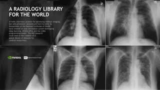 61
A RADIOLOGY LIBRARY
FOR THE WORLD
AI holds enormous promise for advancing medical imaging,
but well-annotated datasets are hard to come by.
Researchers at the National Institutes of Health
have created an auto-annotation system leveraging
deep learning, NVIDIA GPUs and the CUDA
programming model. The NIH research
could lead to the creation of a
global library of datasets for
medical researchers.
 