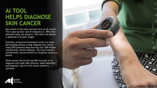 87
Skin cancer is the most common form of all cancers.
The 5-year survival rate of melanoma is ~98% when
detected early, but drops to <20% when the disease
is detected in its later stages.
Scientists at Stanford University’s AI lab are using
dermatology photos to help diagnose skin cancer.
Using GPU-powered deep learning and 130K images
representing >2K skin diseases, the team trained a
convolutional neural network to recognize cancerous
lesions.
When tested, the AI tool was 90% accurate in its
diagnosis and could help clinicians speed detection
and diagnosis—key to a skin cancer patient’s
outcome.
AI TOOL
HELPS DIAGNOSE
SKIN CANCER
Image credit: Matt Young
 