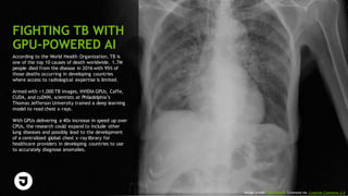 93
According to the World Health Organization, TB is
one of the top 10 causes of death worldwide. 1.7M
people died from the disease in 2016 with 95% of
those deaths occurring in developing countries
where access to radiological expertise is limited.
Armed with >1,000 TB images, NVIDIA GPUs, Caffe,
CUDA, and cuDNN, scientists at Philadelphia’s
Thomas Jefferson University trained a deep learning
model to read chest x-rays.
With GPUs delivering a 40x increase in speed up over
CPUs, the research could expand to include other
lung diseases and possibly lead to the development
of a centralized global chest x-ray library for
healthcare providers in developing countries to use
to accurately diagnose anomalies.
FIGHTING TB WITH
GPU-POWERED AI
Image credit: Yale Rosen. Licensed via Creative Commons 2.0
 