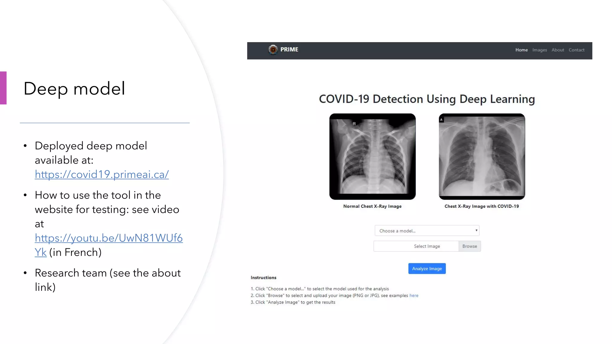 Deep learning for covid 19 detection on chest x-ray | PPT