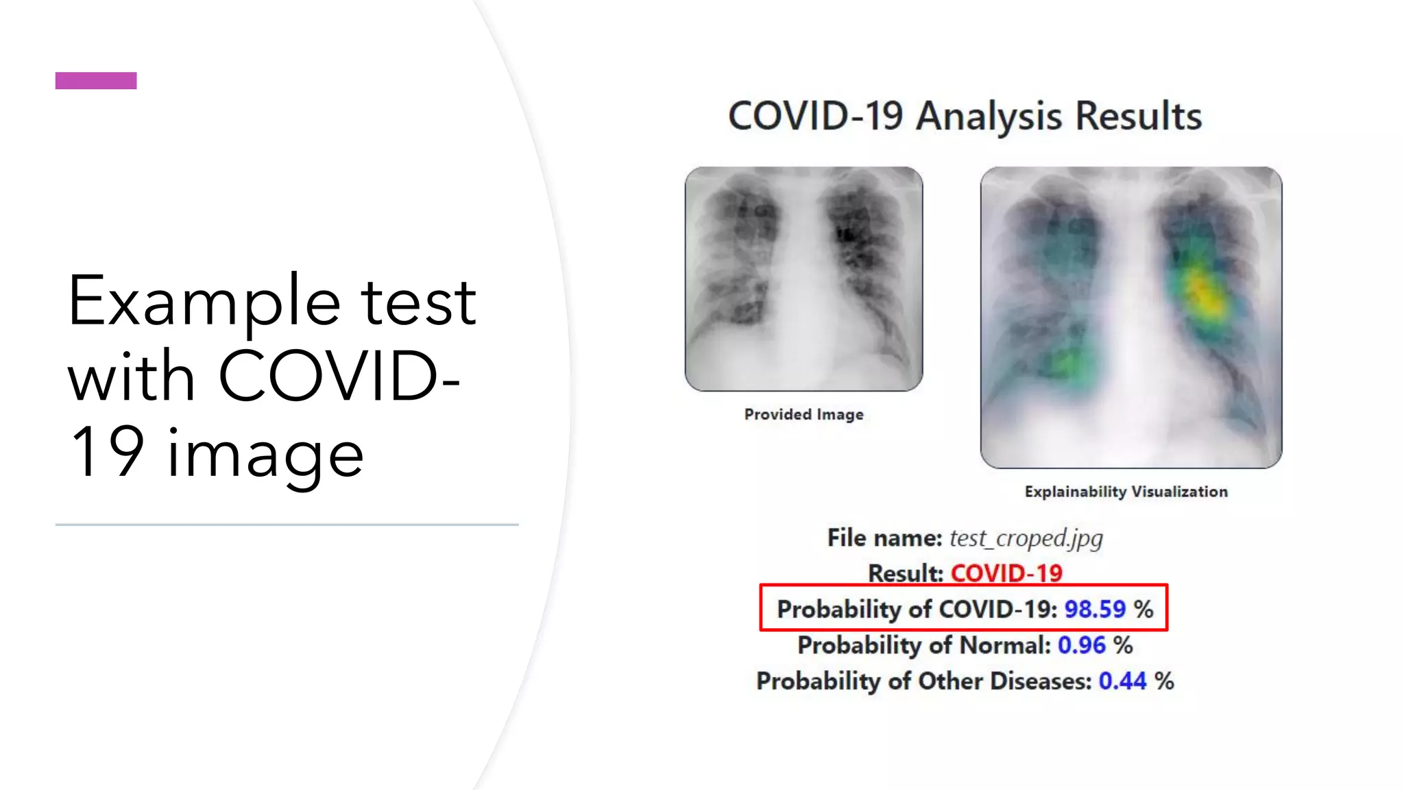 Deep learning for covid 19 detection on chest x-ray | PPT