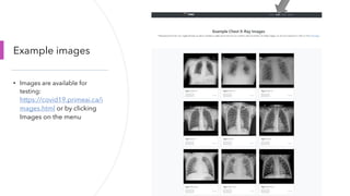 Deep learning for covid 19 detection on chest x-ray | PPT