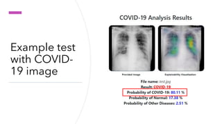 Deep learning for covid 19 detection on chest x-ray | PPT