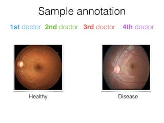 Healthy Disease
0
Major vote is used
1
4
3
4
1st doctor 2nd doctor 3rd doctor 4th doctor
Sample annotation
 