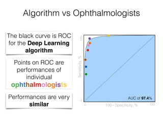 Deep Learning algorithm
can operate in any point
on the curve
Sensitivity,%
100 - Speciﬁcity, %
0100
0 100
AUC of 97.4%
Al...