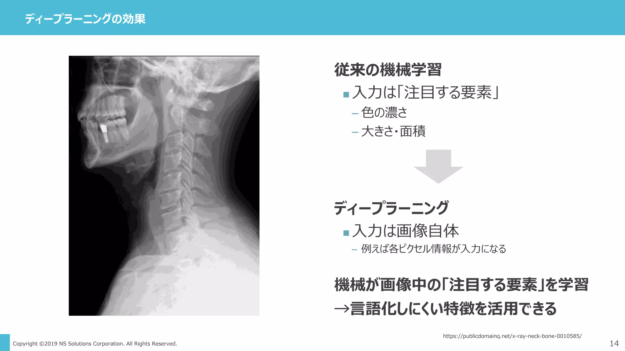 Copyright ©2019 NS Solutions Corporation. All Rights Reserved.
ディープラーニングの効果
14
https://publicdomainq.net/x-ray-neck-bone-0010585/
従来の機械学習
 入力は「注目する要素」
– 色の濃さ
– 大きさ・面積
ディープラーニング
 入力は画像自体
– 例えば各ピクセル情報が入力になる
機械が画像中の「注目する要素」を学習
→言語化しにくい特徴を活用できる
 