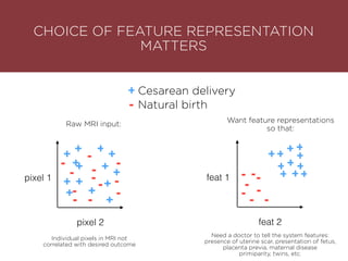 +
pixel 1
+
++
+
++
+
+
+
+
+
+
+--
-
-
-
-
-
-
- -
-
-
-
pixel 2
+
-
Cesarean delivery
Natural birth
Individual pixels in MRI not
correlated with desired outcome
CHOICE OF FEATURE REPRESENTATION
MATTERS
feat 1
feat 2
-
-
-
-
--
-
+ +
+
+
+ +
+
+
+ +
+
-
Want feature representations
so that:
Need a doctor to tell the system features:
presence of uterine scar, presentation of fetus,
placenta previa, maternal disease
primiparity, twins, etc.
Raw MRI input:
 