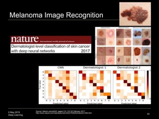 6 May 2019
Deep Learning
Melanoma Image Recognition
64
Source: Nature volume542, pages115–118 (02 February 2017
http://www...
