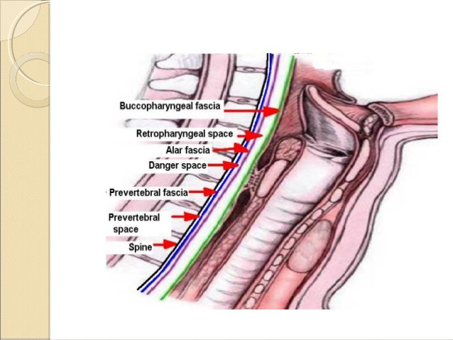 Image result for deep space neck infections em