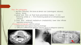 Plain film radiography
1. Jaw films (Panorex): thin bone at dental root (odontogenic abscess);
salivary stones
2.Lateral neck films: air- fluid level; prevertebral shadow > 5 mm
thickening (child) or > 7mm thickening (adult) at C2 (retropharyngeal
infection)
3. Chest films : widened mediastinum (mediastinitis); lower lobe infltrate
(aspiration pneumonia)
Computed tomography with IV contrast
1. Determines neck spaces requiring drainage.
2. Difficult to differentiate between abscess (pus) or phlegmon (edema).
 