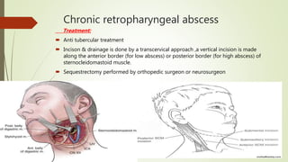 Chronic retropharyngeal abscess
Treatment:
 Anti tubercular treatment
 Incison & drainage is done by a transcervical approach ,a vertical incision is made
along the anterior border (for low abscess) or posterior border (for high abscess) of
sternocleidomastoid muscle.
 Sequestrectomy performed by orthopedic surgeon or neurosurgeon
 