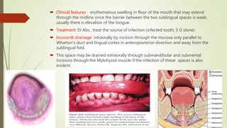  Clinical features : erythematous swelling in floor of the mouth that may extend
through the midline since the barrier between the two sublingual spaces is weak,
usually there is elevation of the tongue.
 Treatment: IV Abs , treat the source of infection (infected tooth, S G stone)
 Incision& drainage: intraorally by incision through the mucosa only parallel to
Wharton's duct and lingual cortex in anteroposterior direction and away from the
sublingual fold.
 This space may be drained extraorally through submandibular and submental
incisions through the Mylohyoid muscle if the infection of these spaces is also
evident.
 